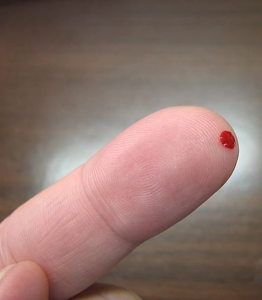Prelievo per gli esami del sangue